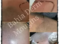 Bahia Derm Mougins